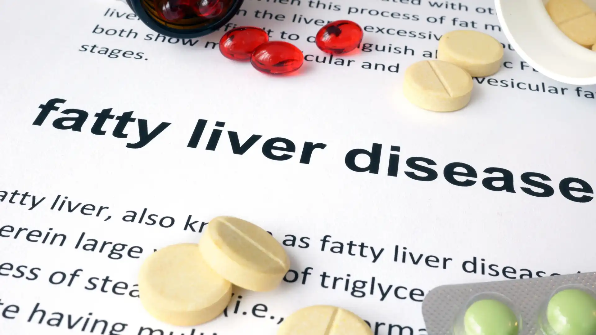 Fatty Liver