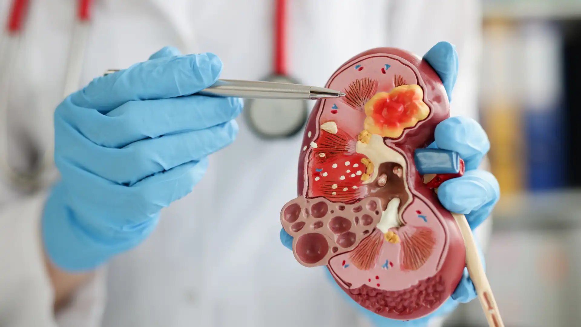 Kidney Issues